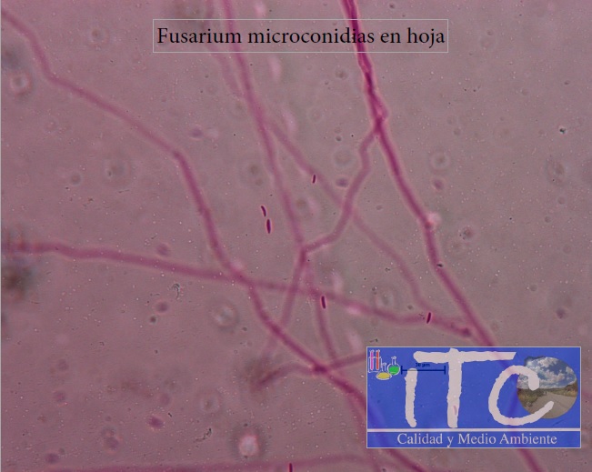 Resultado de estudio de microscopía de tinción. Presencia de Fusarium en hojas de nogal (Juglans regia)